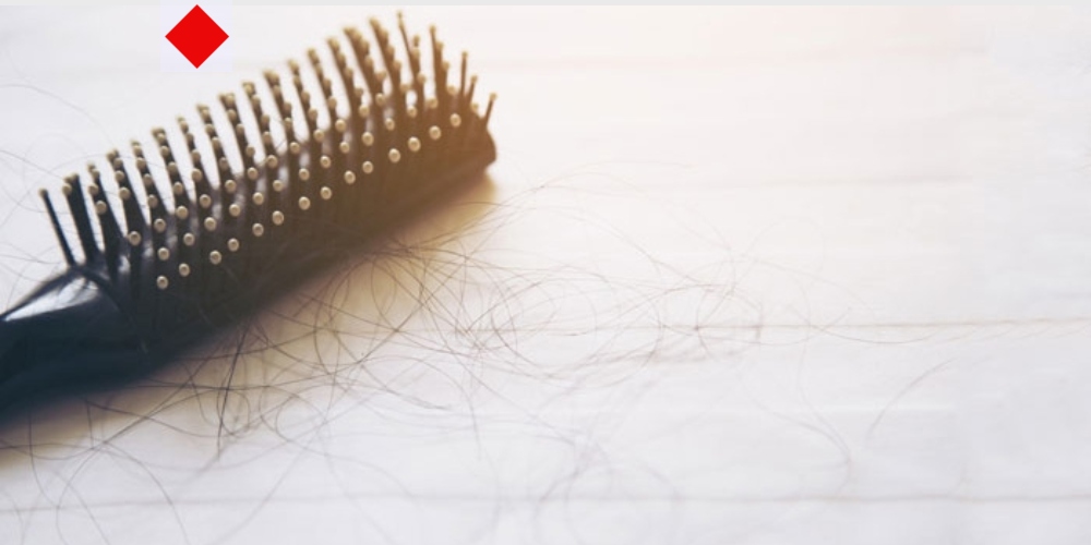 অ্যালোপেসিয়া বা চুল পড়ায় ঘরোয়া সমাধানগুলো জেনে রাখুন