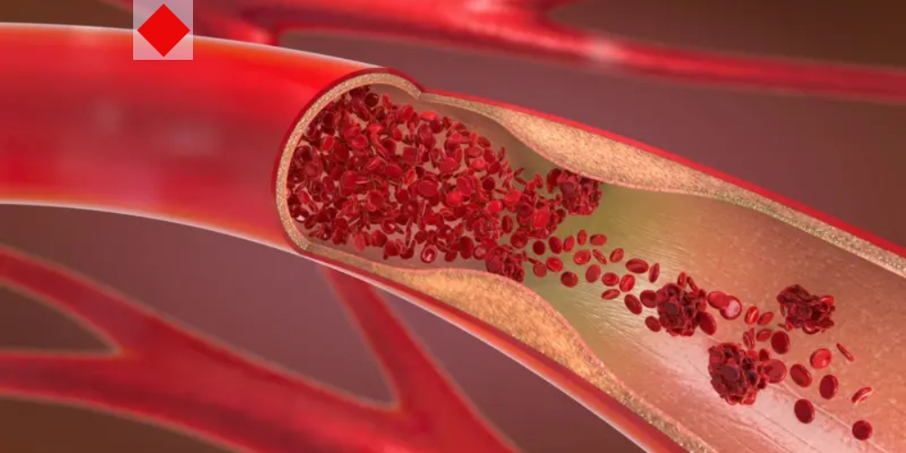 হঠাৎ মৃত্যুর আগে যে সংকেতগুলো জানিয়ে যায় শরীর
