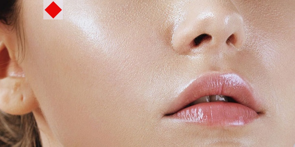 ত্বক অতিরিক্ত তেলতেলে? ৭টি সহজ উপায়েই করুন সমাধান