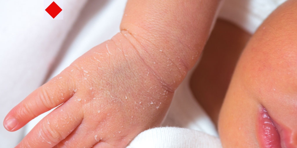 শিশুর কোমল ত্বকে তেল, ক্রিম না লোশন